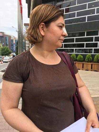 Kuafördeki kimyasal madde saçını yaktı