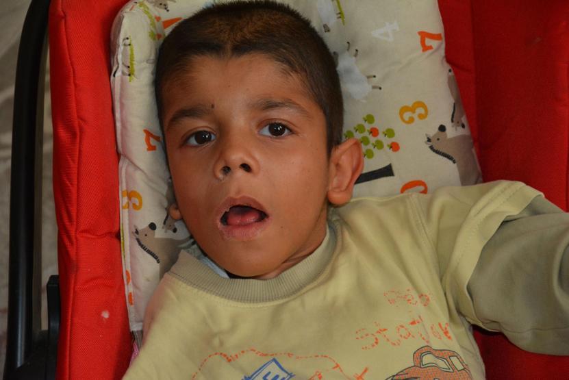 15 yaşında 48 mide kanaması 17 ameliyat geçirdi