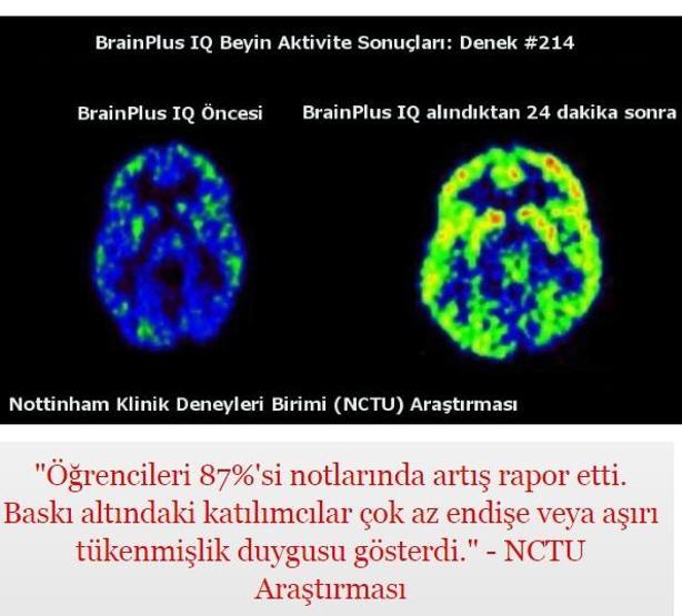 Dolandırıcılıkta son nokta: Beyin viagrası