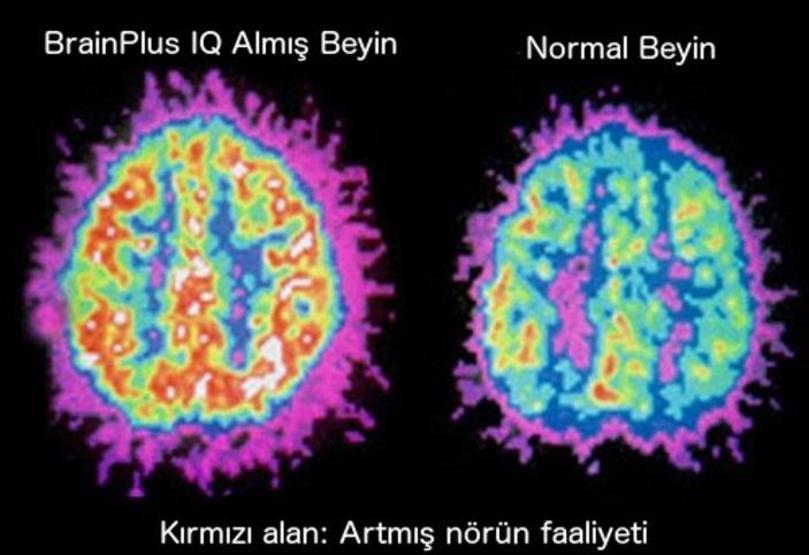 Dolandırıcılıkta son nokta: Beyin viagrası