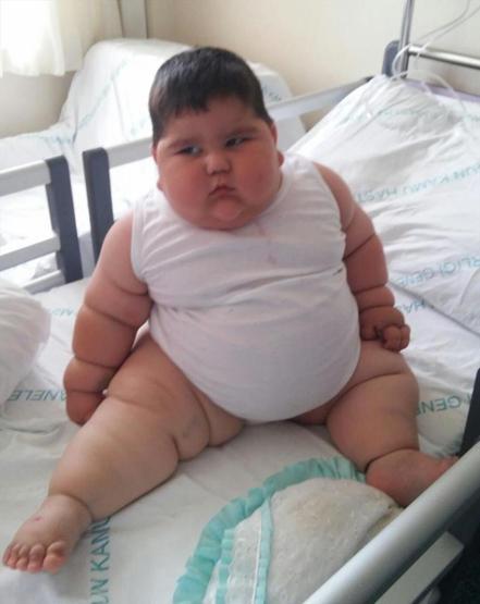 1,5 aylık bebek şimdiden 36 kiloya ulaştı