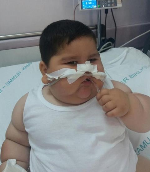 1,5 aylık bebek şimdiden 36 kiloya ulaştı