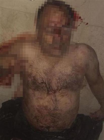 Antalyada 5 yıldızlı otelde kavga çıktı, oda ateşe verildi