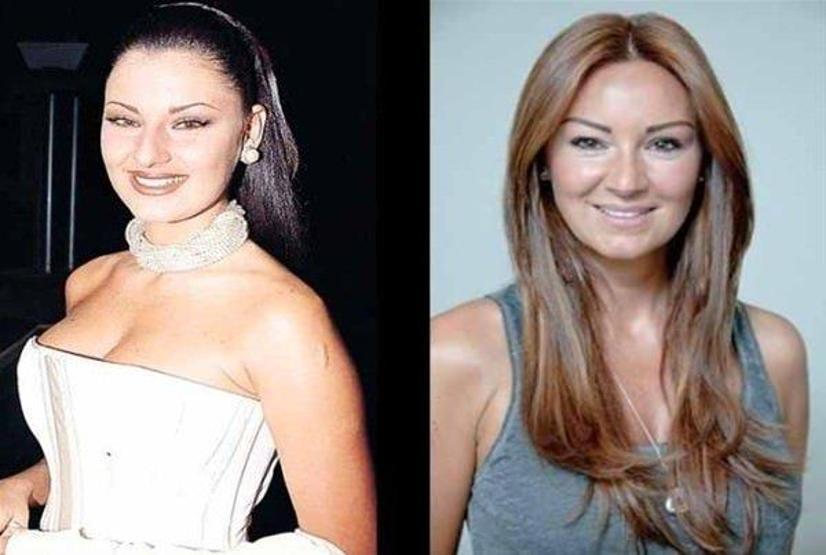 Sılanın estetiksiz hali şoke etti