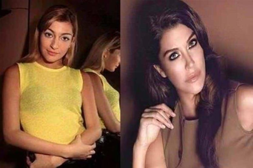 Sılanın estetiksiz hali şoke etti