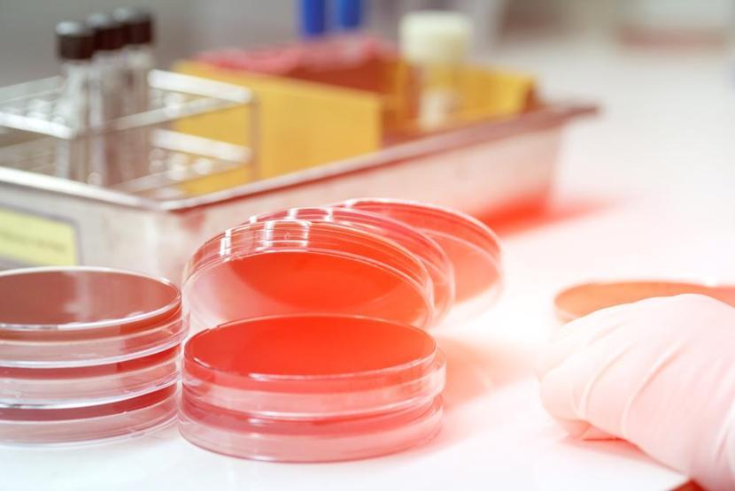 Her yıl 31 milyon 500 bin kişide sepsis hastalığı ortaya çıkıyor