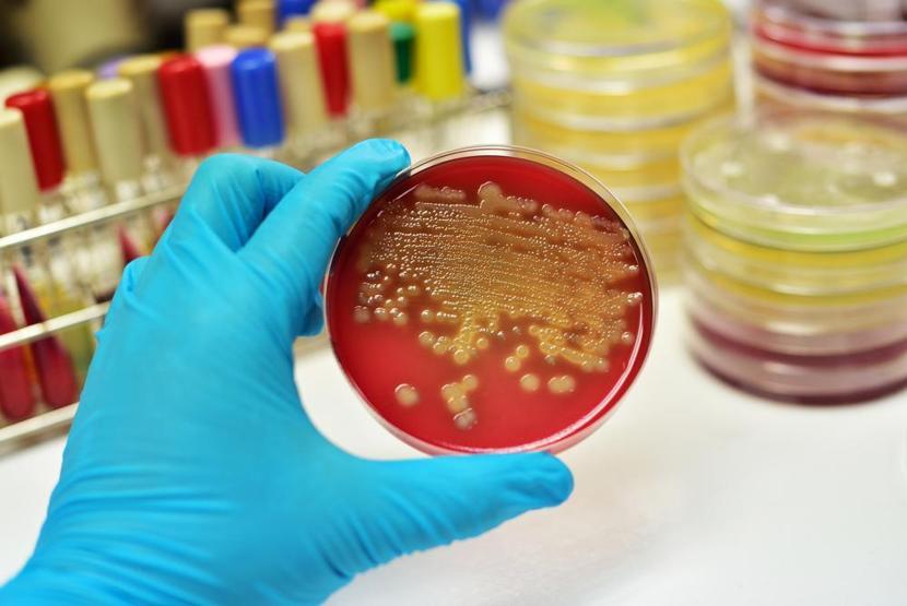 Her yıl 31 milyon 500 bin kişide sepsis hastalığı ortaya çıkıyor