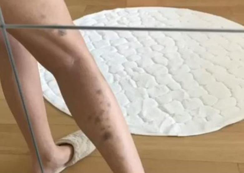 Ünlü şarkıcıdan anokresiya itirafı