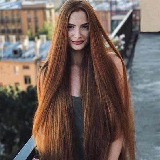 Meğer 18 yaşında kelmiş... Şimdi ise
