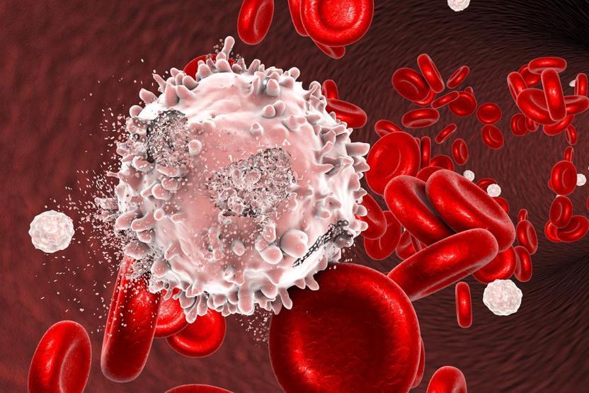 Kanser tedavisinde devrim: Kemoterapisiz sonuç alındı