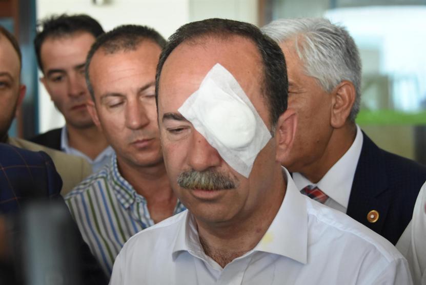 Yumurta silah sayıldı. CHPli Recep Gürkana saldırana hapis cezası