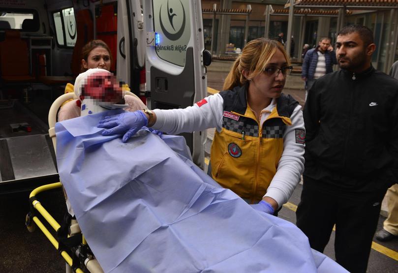 Adanada eski eşini komalık eden kadın adliyede