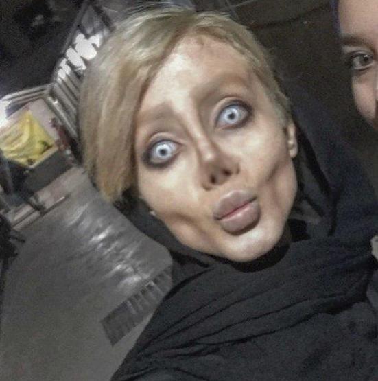 Angelina Jolie’ye benzemek için makyajla mı böyle görünüyor