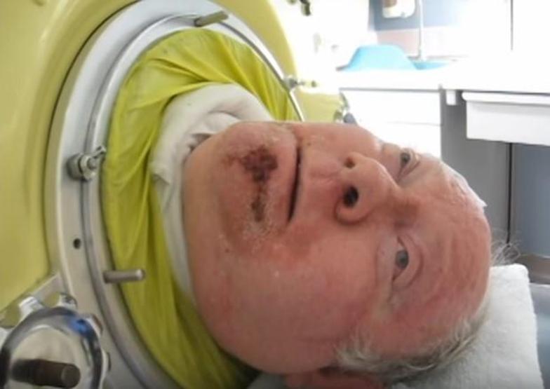 Tam 67 yıldır Çelik Ciğerin içinde yaşamını sürdürüyor