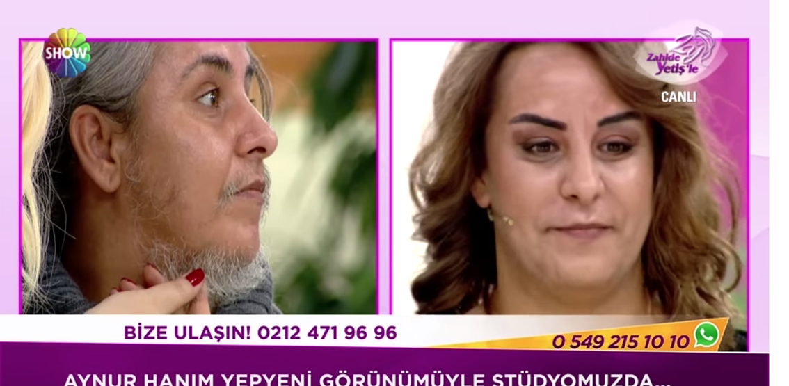 Ona Sakallı Aynur diyorlardı. Son hali herkesi şaşırttı