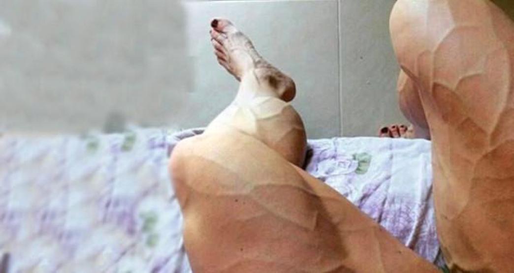 Bacak kasları ile fenomen haline geldi