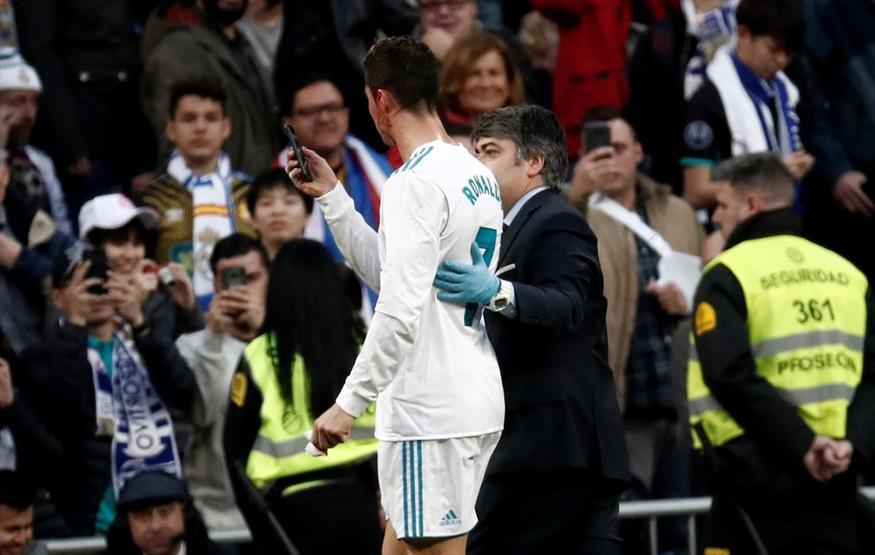 Realin 7 gol attığı maçta Cristiano Ronaldo kanlar içinde kaldı