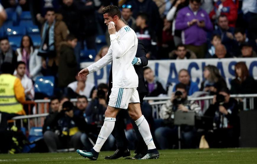 Realin 7 gol attığı maçta Cristiano Ronaldo kanlar içinde kaldı
