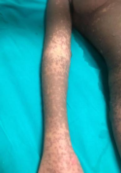 Psikiyatristin verdiği ilaçları kullandı, şimdi yoğun bakımda
