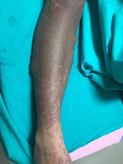 Psikiyatristin verdiği ilaçları kullandı, şimdi yoğun bakımda