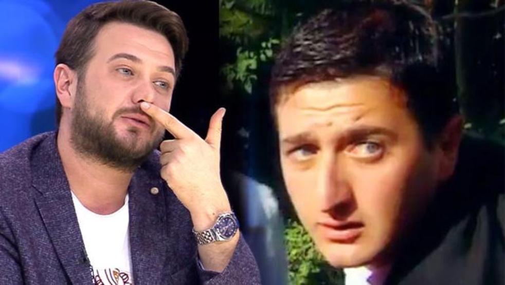 Onur Büyüktopçu’nun estetiksiz hali şaşırttı