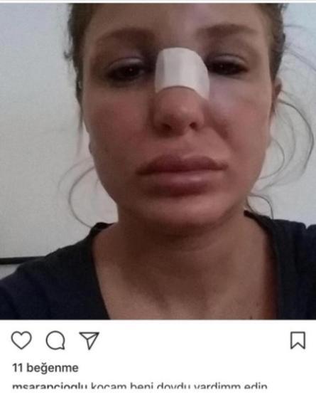 Berk Oktay ve eşi Merve Şarapçıoğlu hacker kurbanı oldu