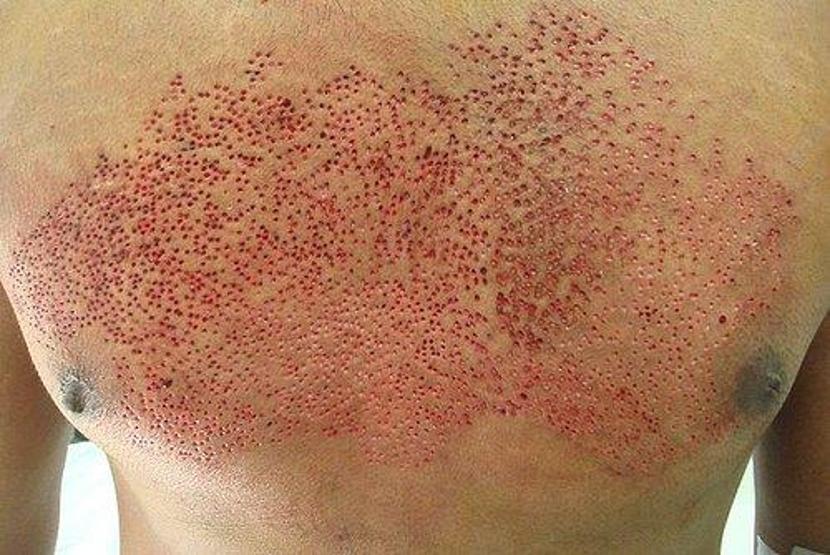 Bu şekli gördüğünüzde rahatsız oluyor musunuz Nedenine şaşıracaksınız