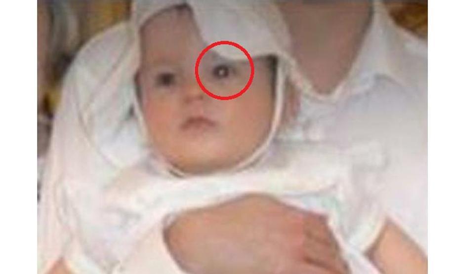 Gözündeki değişimi fark etti, çocuğunun hayatını kurtardı