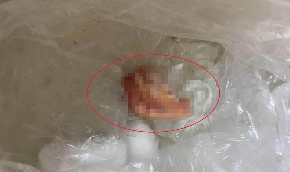 Genç kadın kavgada arkadaşının kulağını ısırarak kopardı