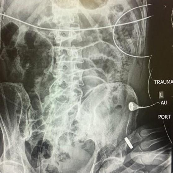 Dehşet verici anları böyle paylaştılar: Olduğum yer şu anda böyle gözüküyor