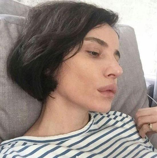 Ebru Gündeş köfte dudak modasına uydu