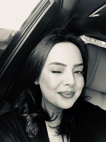 Ebru Gündeş köfte dudak modasına uydu