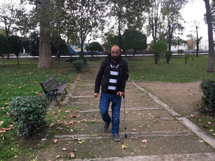 Maymuna benziyorsun dediler, hayata küstü