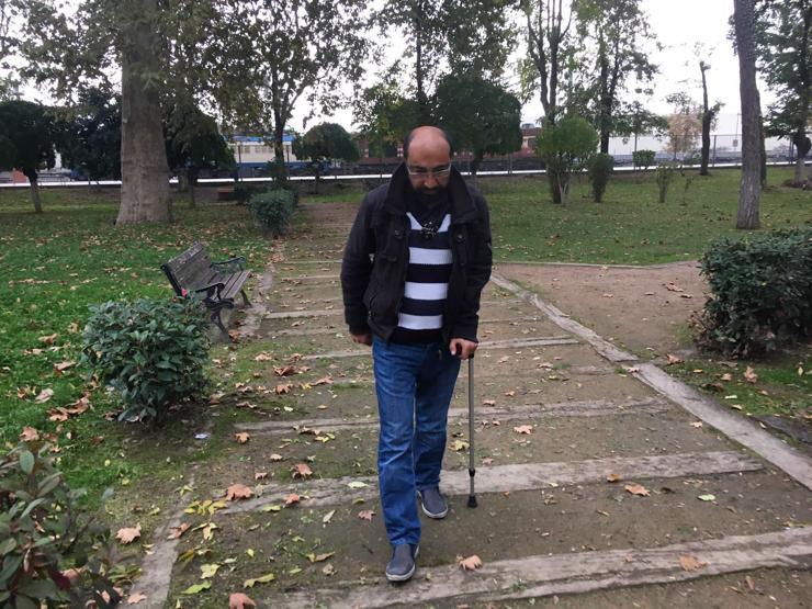 Maymuna benziyorsun dediler, hayata küstü
