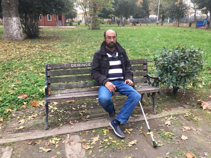 Maymuna benziyorsun dediler, hayata küstü
