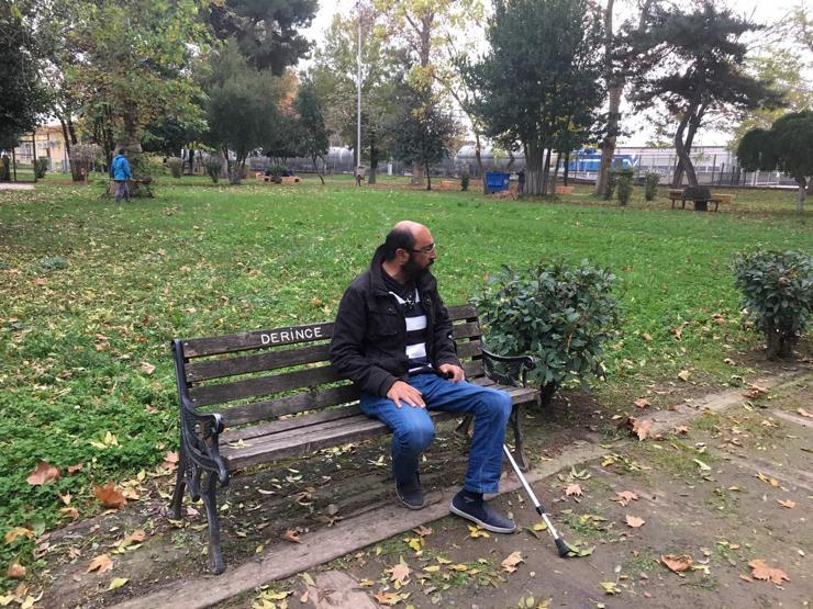 Maymuna benziyorsun dediler, hayata küstü