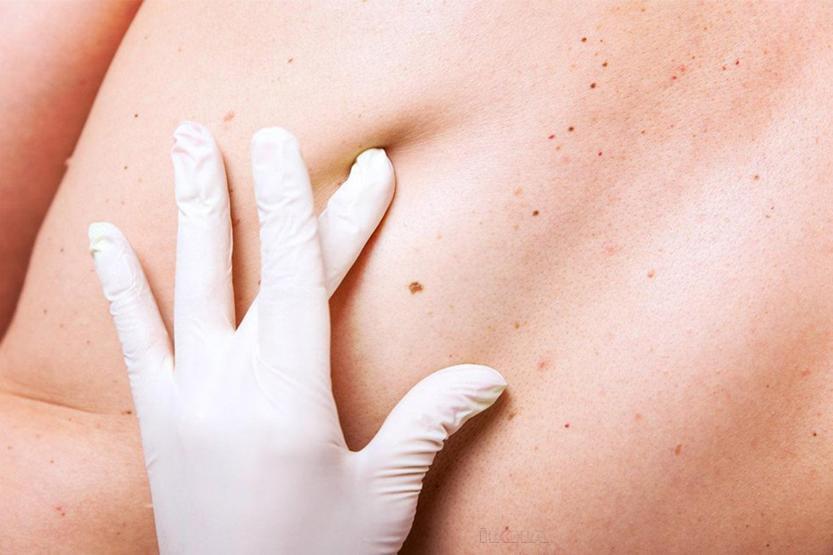 Benlerdeki bu değişimlere dikkat