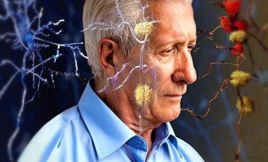 Alzheimerı önlemenin yolları