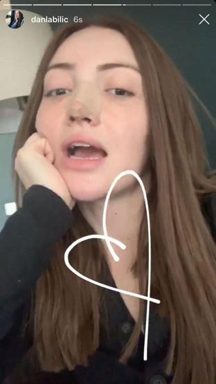Danla Bilic burun estetiği oldu