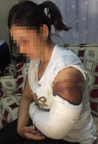 Kocası inşaat demiriyle döverek bu hale getirdi