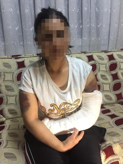 Kocası inşaat demiriyle döverek bu hale getirdi