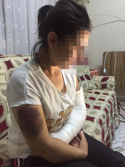 Kocası inşaat demiriyle döverek bu hale getirdi