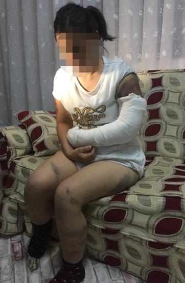 Kocası inşaat demiriyle döverek bu hale getirdi