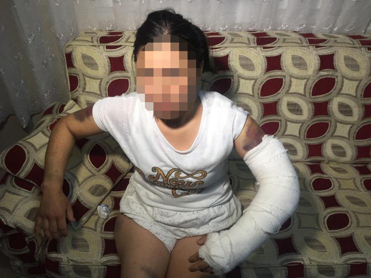 Kocası inşaat demiriyle döverek bu hale getirdi