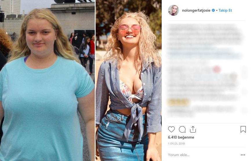 127 kiloya kadar çıkmıştı... Son halini görenler inanamıyor