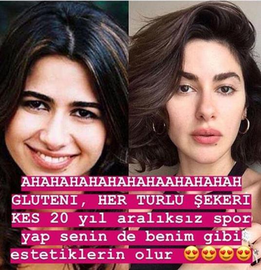 Nesrin Cavadzadeden estetik yorumlarına ilginç yanıt