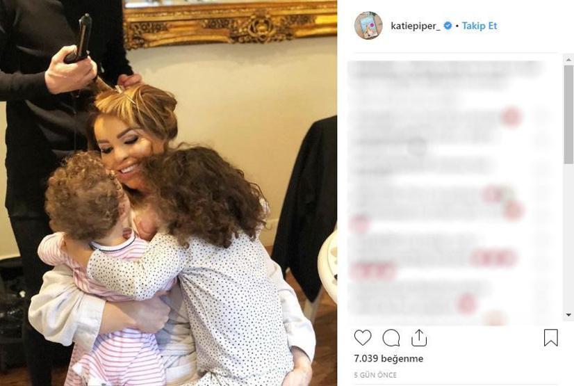 Sevgilisinin asitli saldırısına uğradı, 200den fazla ameliyat geçirdi... Katie Piperın inanılmaz hikayesi
