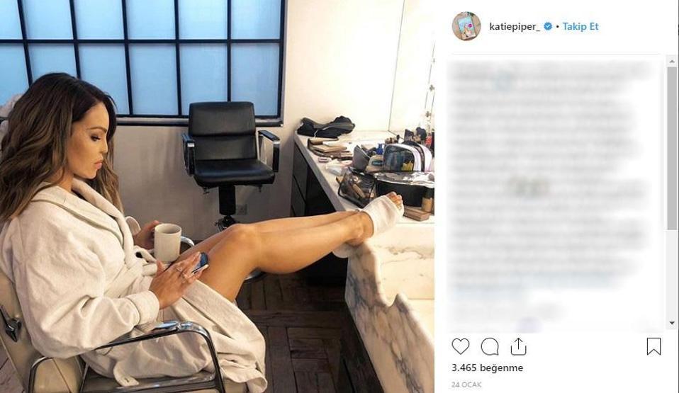 Sevgilisinin asitli saldırısına uğradı, 200den fazla ameliyat geçirdi... Katie Piperın inanılmaz hikayesi