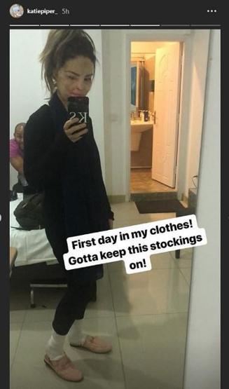 Sevgilisinin asitli saldırısına uğradı, 200den fazla ameliyat geçirdi... Katie Piperın inanılmaz hikayesi