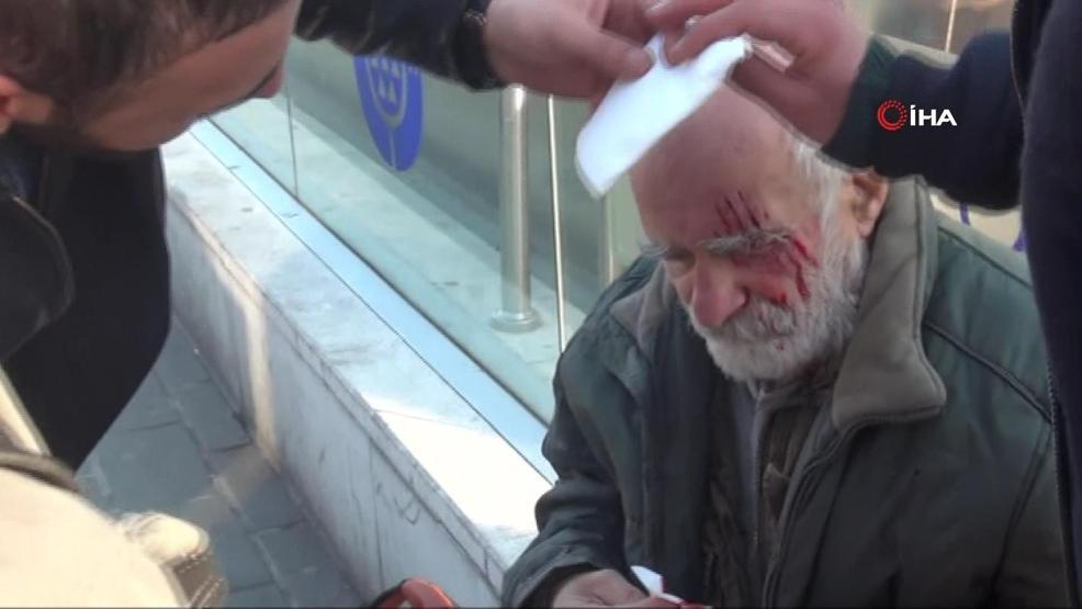 Ünlü oyuncu Taksimde yürüyen merdivenden düşerek yaralandı